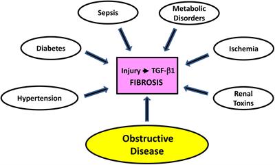 The Genomic Response to TGF-β1 Dictates Failed Repair and Progression of Fibrotic Disease in the Obstructed Kidney